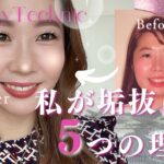 【アラサー女子】私が垢抜けた5つの理由💄💕#アラサー女子 #起業女子#歯科矯正 #ダイエット