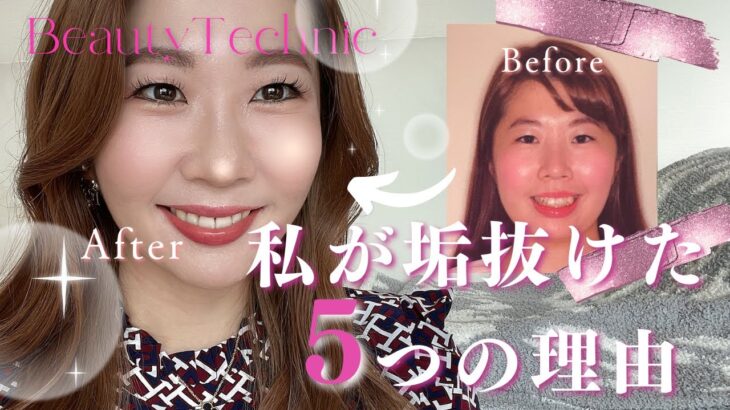 【アラサー女子】私が垢抜けた5つの理由💄💕#アラサー女子 #起業女子#歯科矯正 #ダイエット