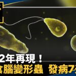 相隔12年再現！　女感染「食腦變形蟲」發病7天不治｜#鏡新聞