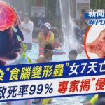 戲水染「食腦變形蟲」女7天亡 致死率99% 專家揭「侵腦途徑」｜新聞”樺”重點PODCAST@tvbsnews02