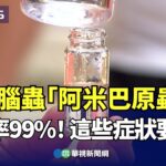 食腦蟲「阿米巴原蟲」死亡率99%！這些症狀要注意｜👍小編推新聞 20230810