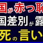 被害者ビジネスお得意の韓国。外国人差別の現状が発覚し赤っ恥か。対日では驚きの見返り主張も