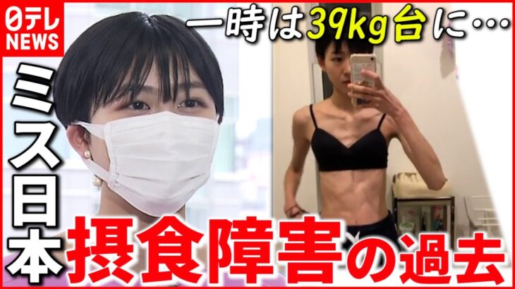 【摂食障害】コロナ禍で10代に増加… 経験した女性が”伝えたいこと”